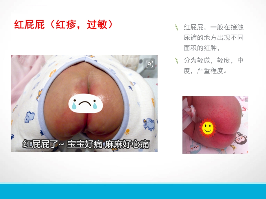 纸尿裤常见售后ppt课件.ppt_第2页