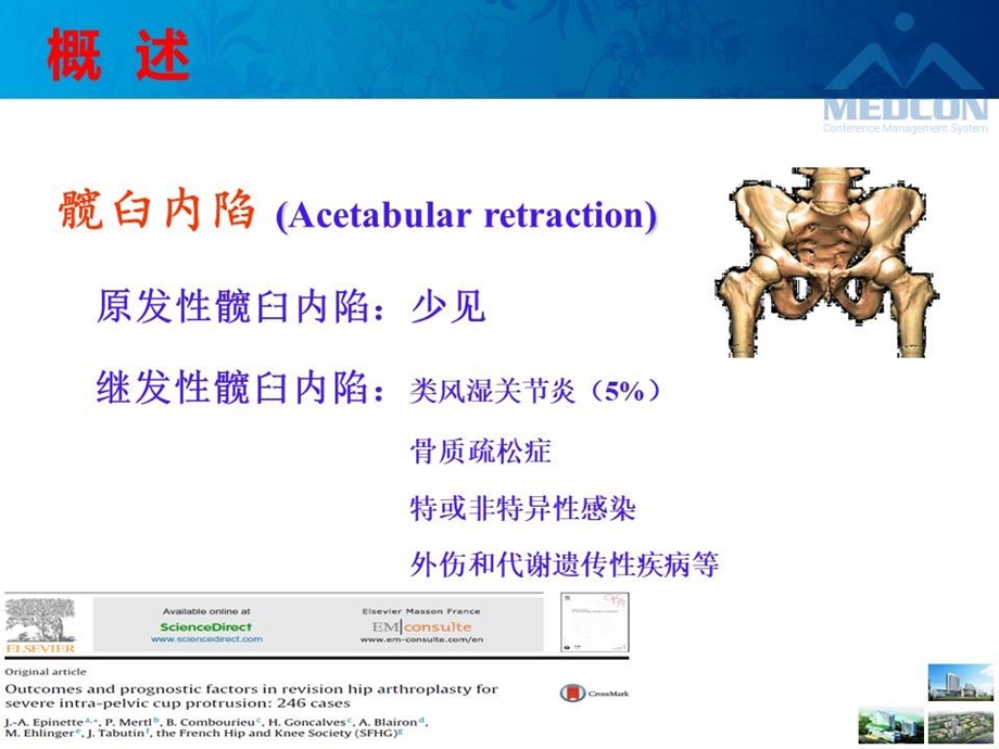 类风湿性关节炎继发严重髋臼内陷的全髋关节置换ppt课件.pptx_第3页