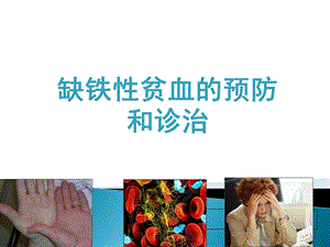 缺铁性贫血的预防与诊治ppt课件.ppt