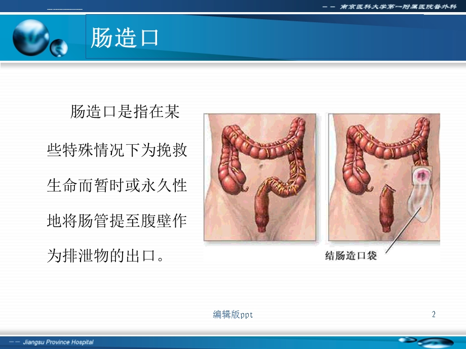 肠造口及其护理PPT课件.ppt_第2页