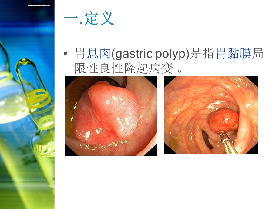 胃息肉内镜手术的护理ppt课件.ppt_第3页