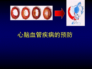 防治心脑血管疾病健康讲座(绝对实用)ppt课件.ppt