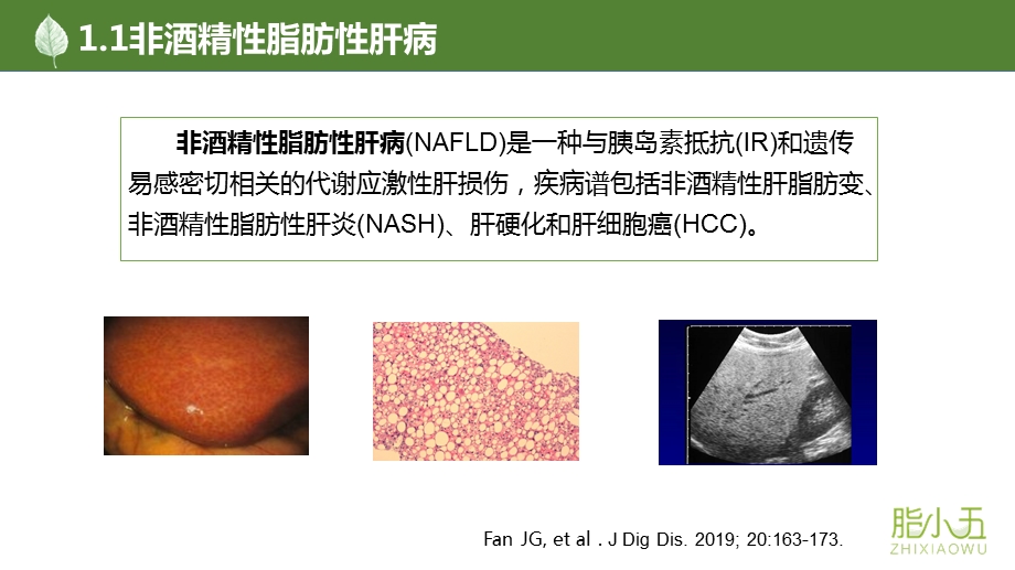 脂小五低碳饮食改善非酒精性脂肪肝合并多囊卵巢综合征的营养干预方式ppt课件.pptx_第3页