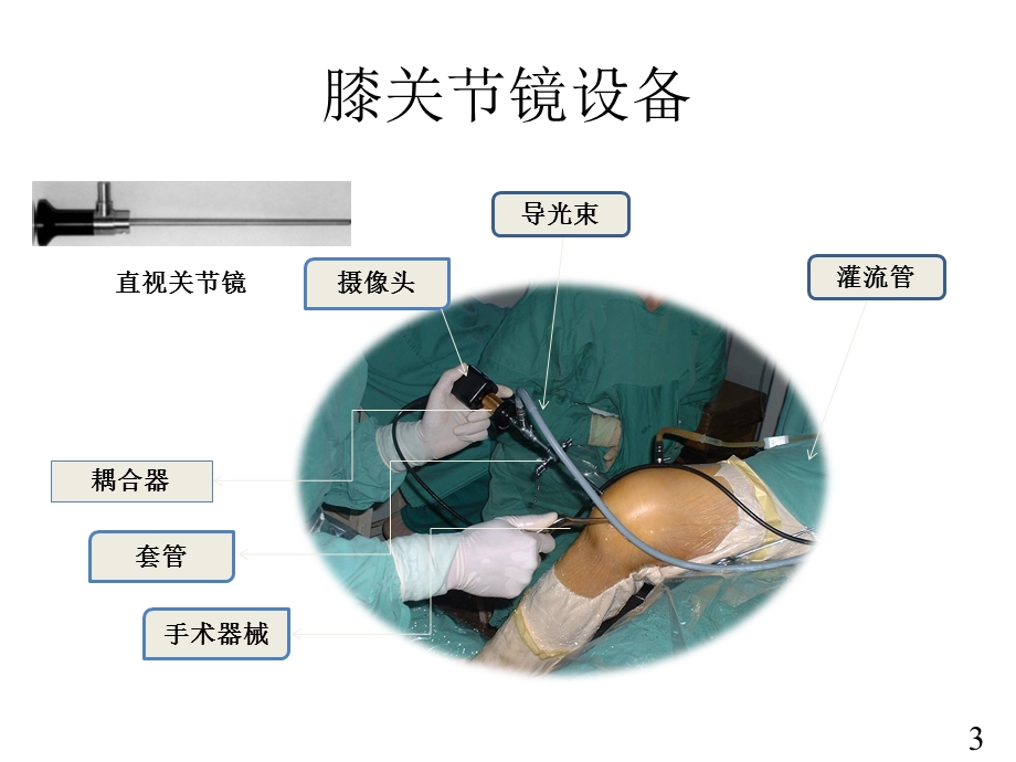 膝关节镜手术的准备体位和ppt课件.pptx_第3页