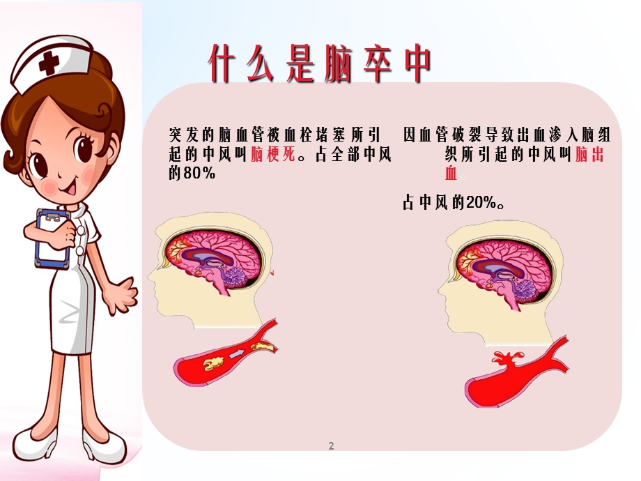 脑卒中护理查房成稿ppt课件.ppt_第2页