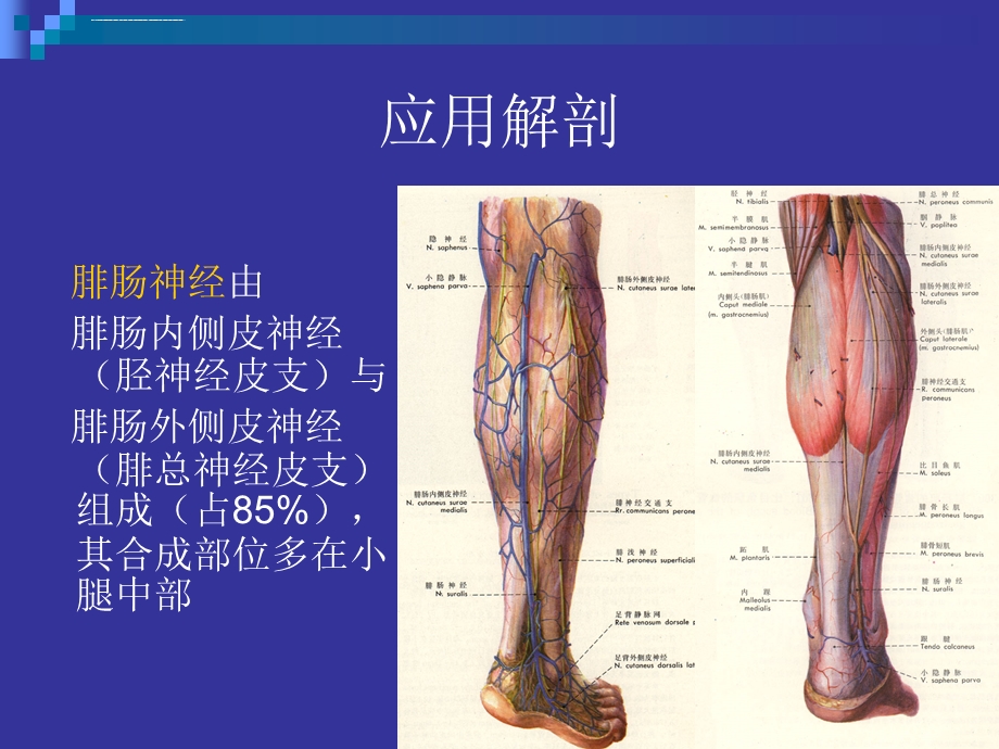 腓肠神经营养血管皮瓣ppt课件.ppt_第3页