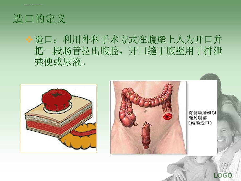 造口袋的更换方法及健康指导ppt课件.ppt_第3页