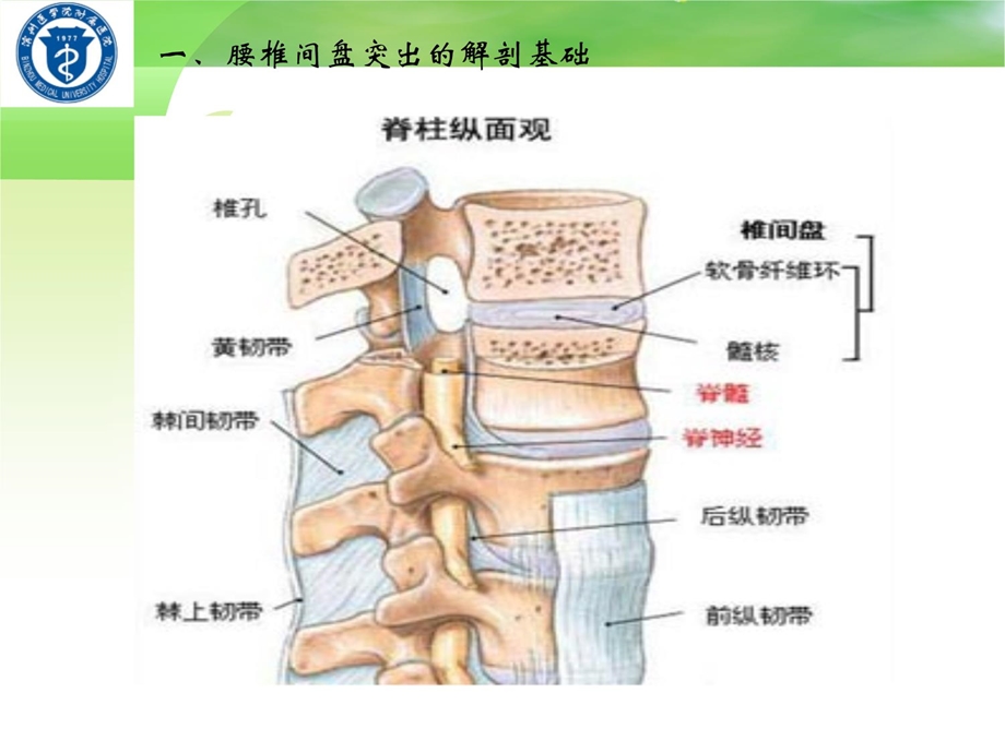 腰椎间盘突出症带教案备注 ppt课件.ppt_第3页