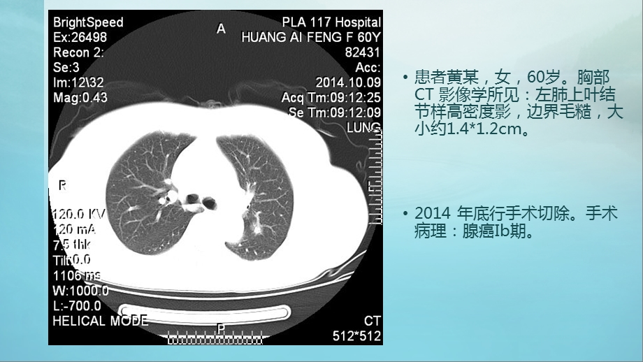 肺结节的诊断策略ppt课件.pptx_第3页