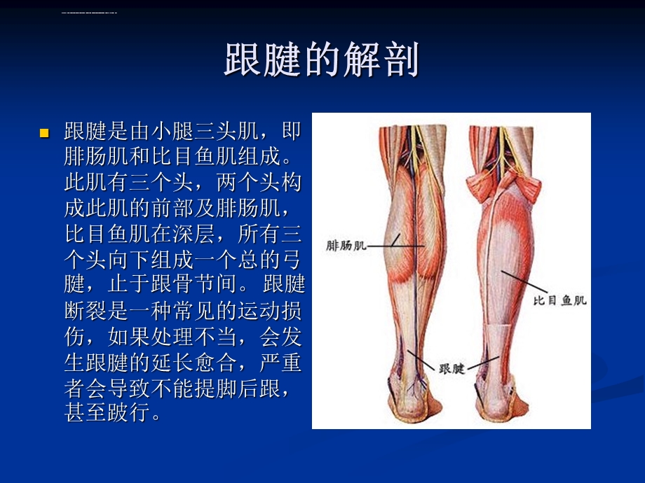 跟腱断裂的康复ppt课件.ppt_第2页