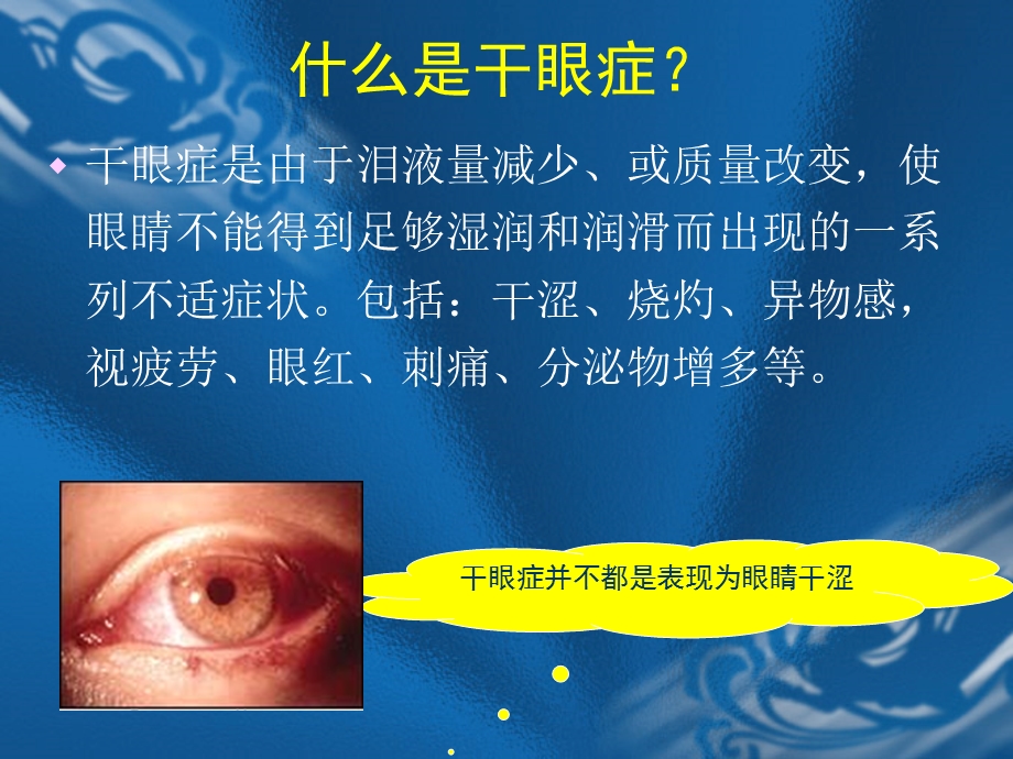 视疲劳与干眼症ppt课件.ppt_第3页