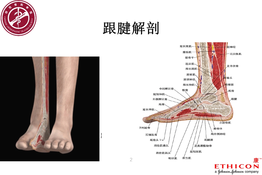 跟腱断裂术后康复流程图ppt课件.ppt_第2页