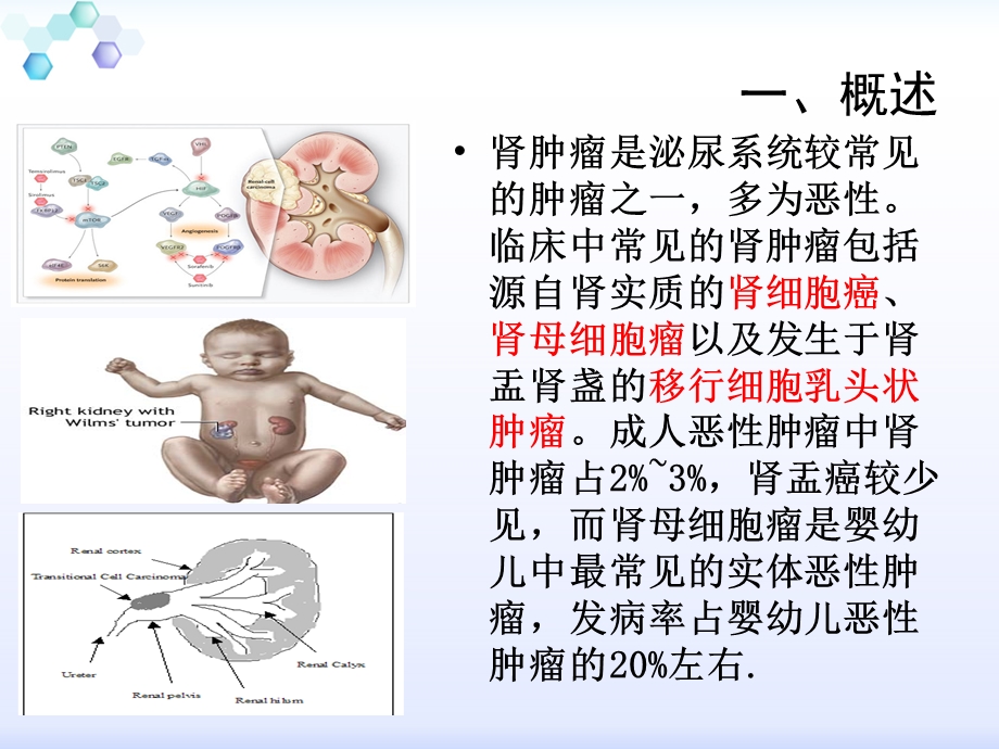 肾癌(护理查房)ppt课件.ppt_第2页