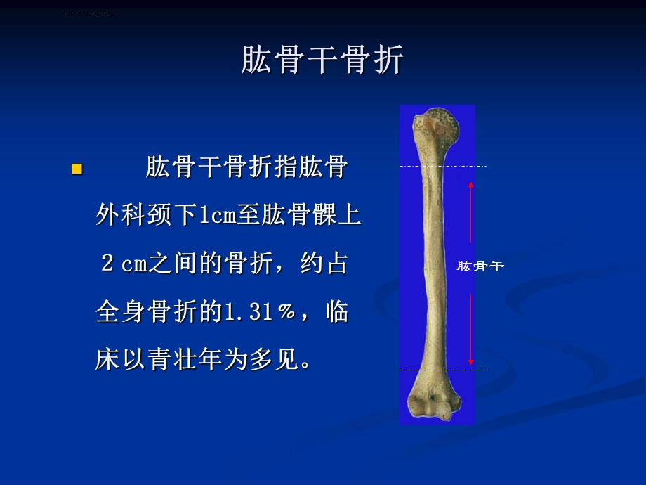 肱骨干骨折ppt课件.ppt_第1页