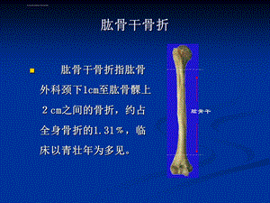 肱骨干骨折ppt课件.ppt