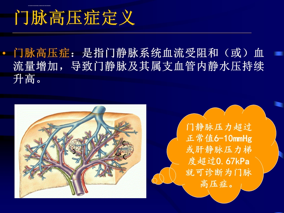 门脉高压症ppt课件.ppt_第2页