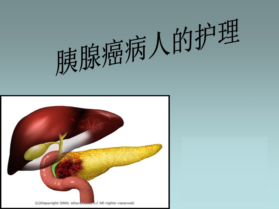 胰腺癌病人的护理ppt课件.ppt_第1页