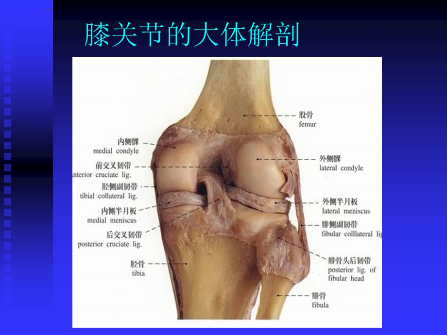 膝关节常见病的诊断与治疗ppt课件.ppt_第3页