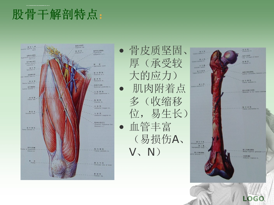 股骨干骨折的护理ppt课件.ppt_第3页