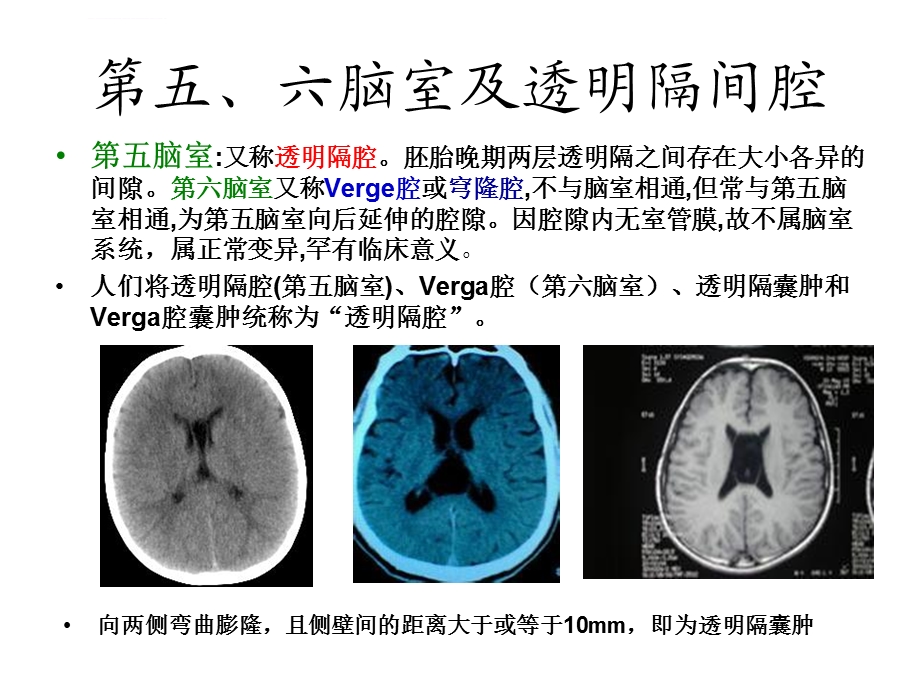 脑室系统及脑脊液循环ppt课件.ppt_第3页