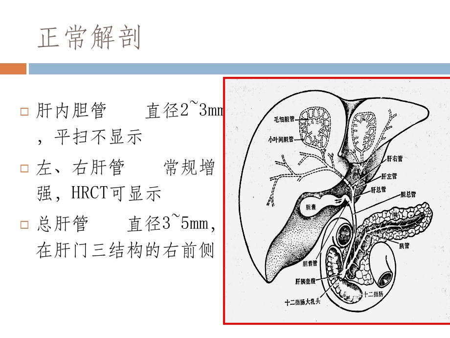 胆系疾病影像诊断ppt课件.ppt_第2页