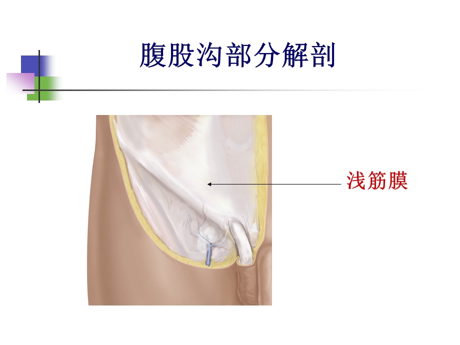 腹股沟解剖图示ppt课件.ppt_第3页