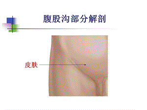 腹股沟解剖图示ppt课件.ppt