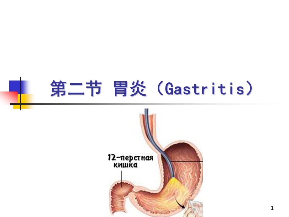 胃炎病人的护理ppt课件.ppt_第1页