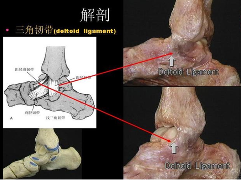 踝关节骨折Laugehansen分型的理解与评价ppt课件.pptx_第2页