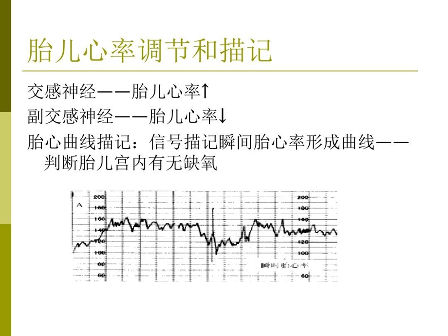 胎心监护及判读说课材料课件.ppt_第2页