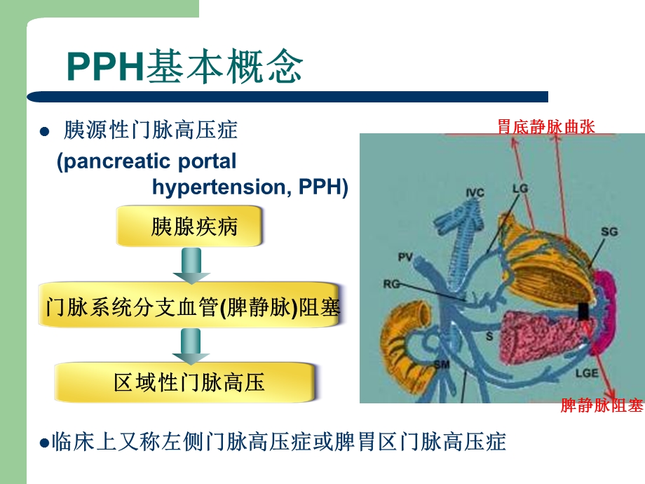 胰源性门脉高压症ppt课件.ppt_第2页