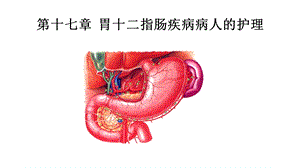 胃十二指肠疾病病人的护理ppt课件.ppt