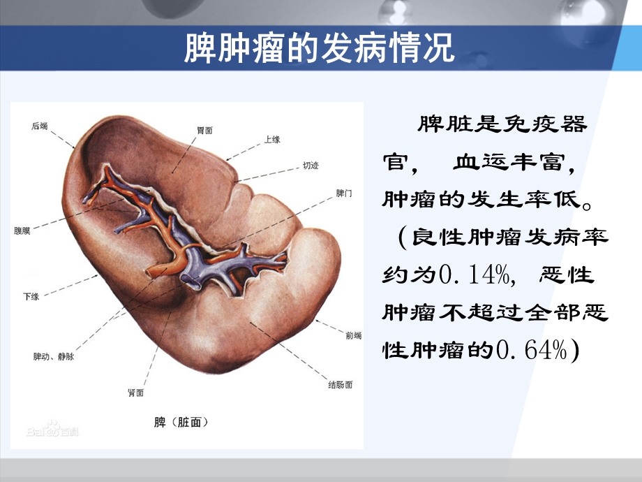 脾脏肿瘤的影像诊断ppt课件.ppt_第3页