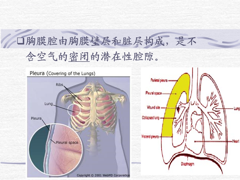 自发性气胸ppt课件.ppt_第2页