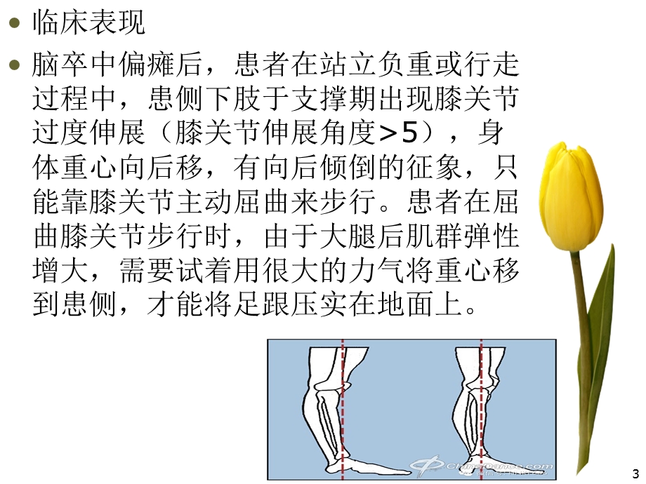 脑卒中膝关节过伸原因分析及康复治疗对策ppt课件.ppt_第3页