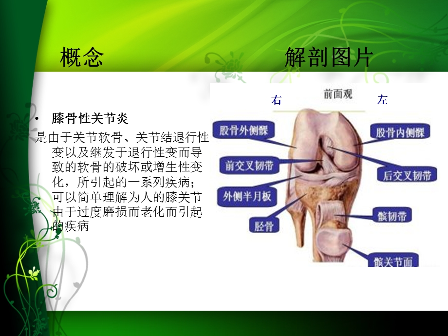 膝关节骨性关节炎护理查房ppt课件.ppt_第3页