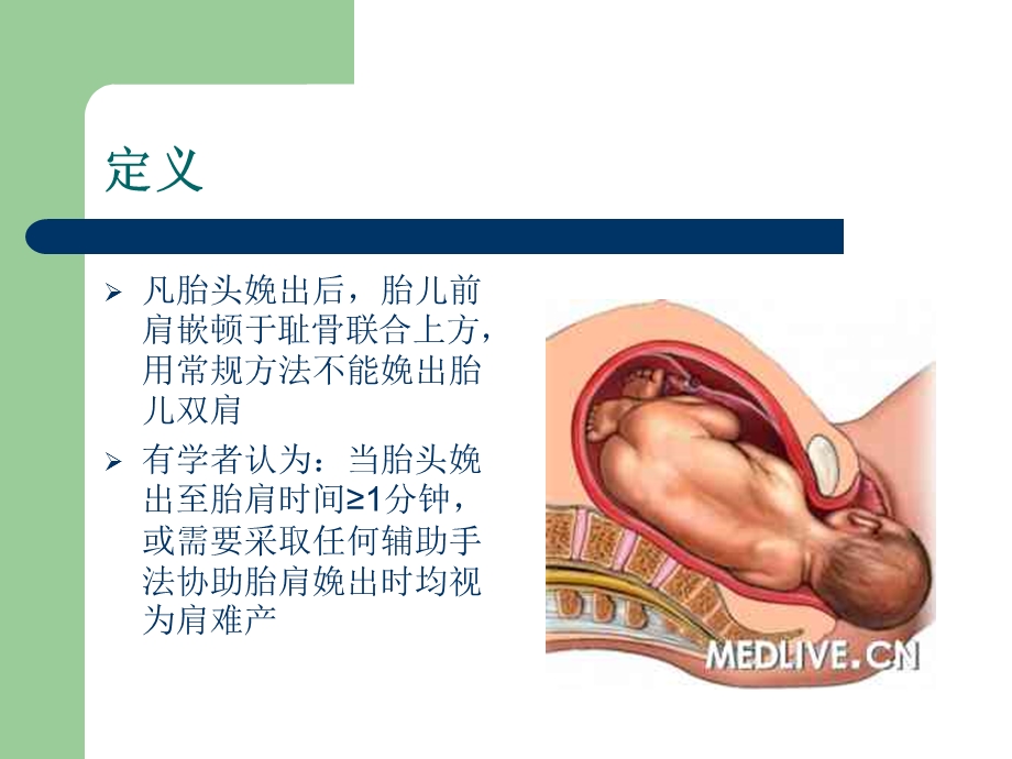 肩难产处理流程ppt课件.ppt_第2页