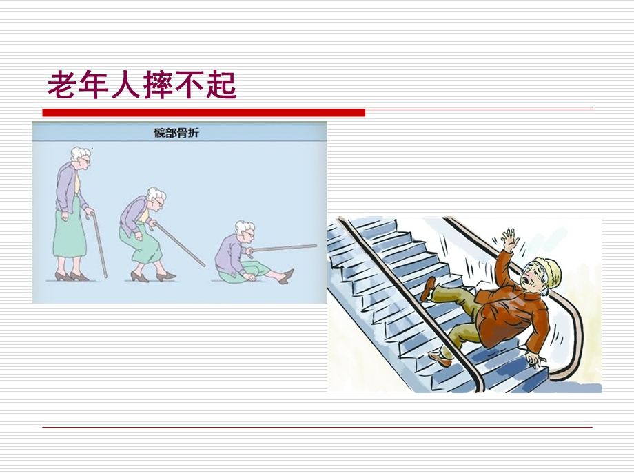 老年髋部骨折ppt课件.ppt_第2页