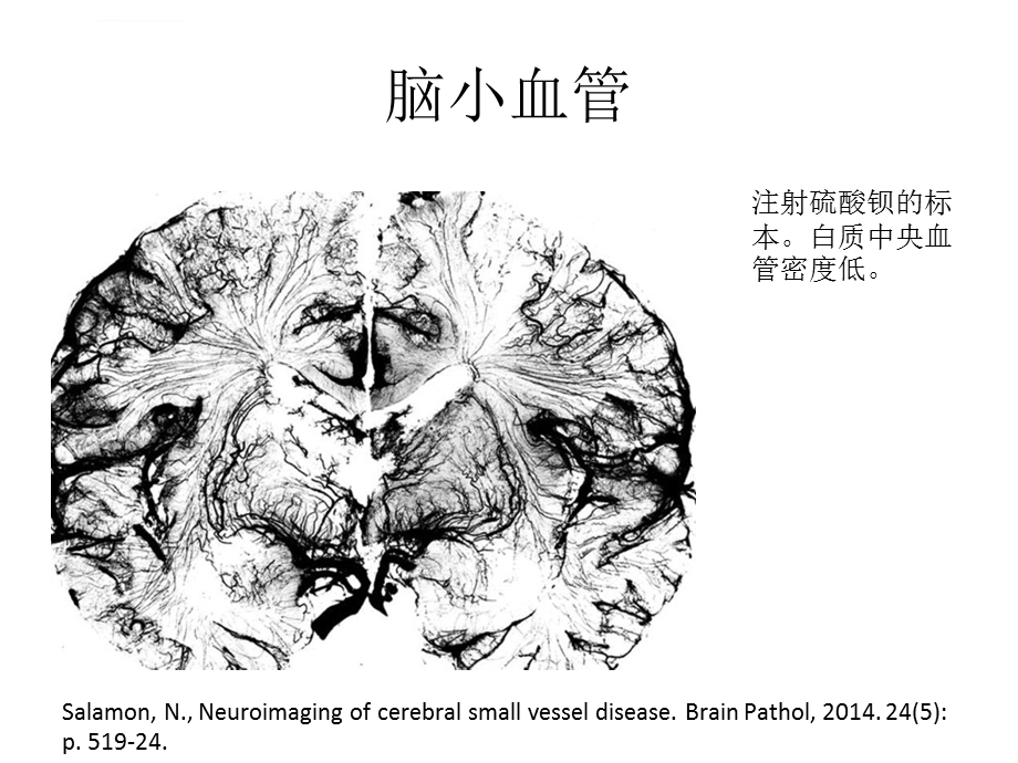 脑小血管病概念与治疗ppt课件.ppt_第2页