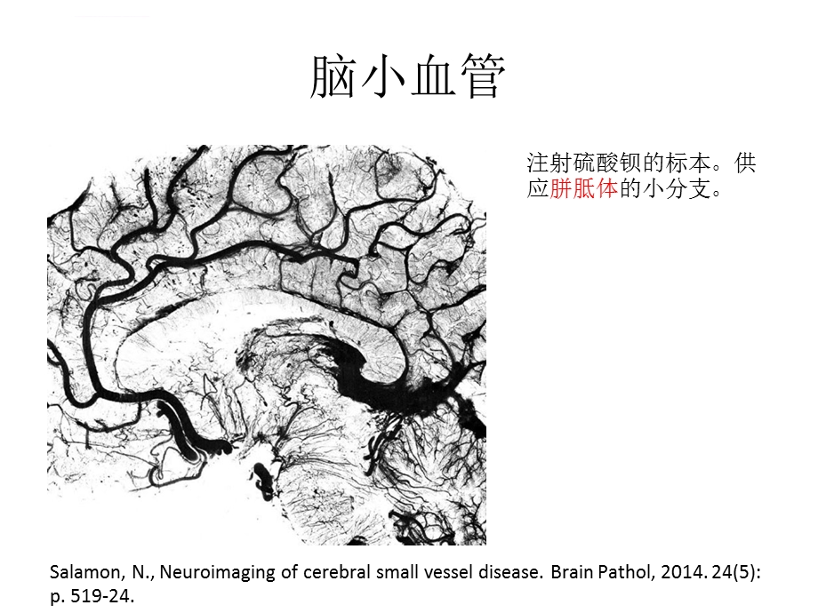 脑小血管病概念与治疗ppt课件.ppt_第3页