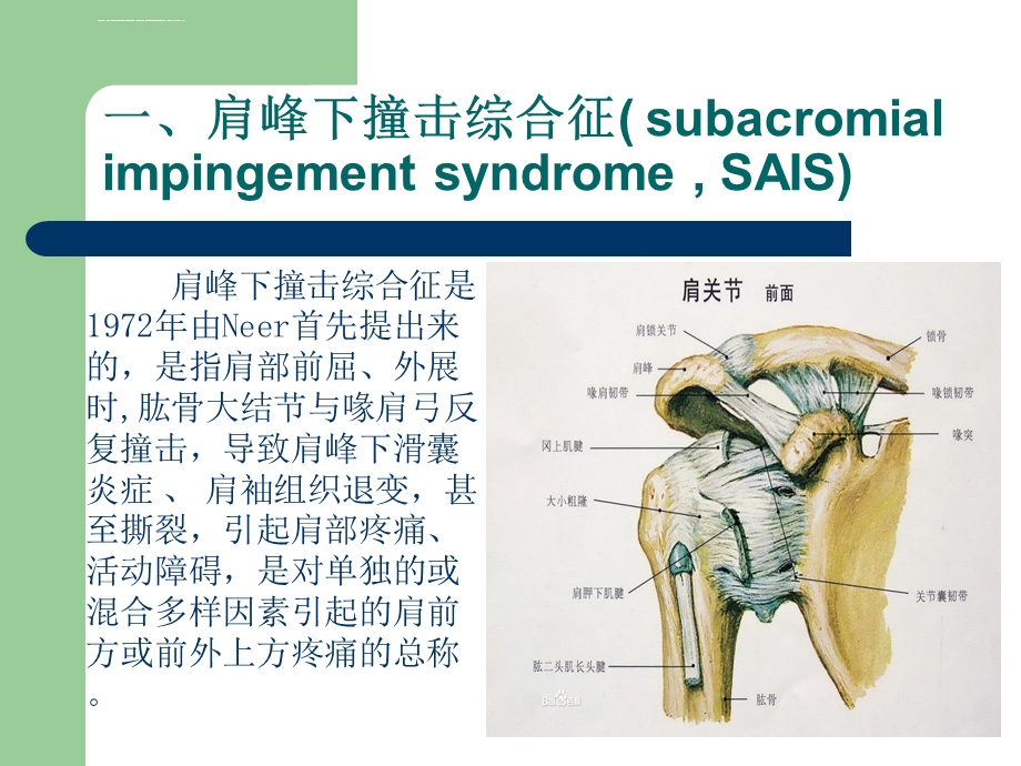 肩峰下撞击综合征ppt课件.ppt_第3页