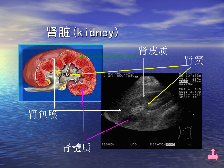 肾脏解剖肾积水肾囊肿的超声诊断学ppt课件.ppt_第3页