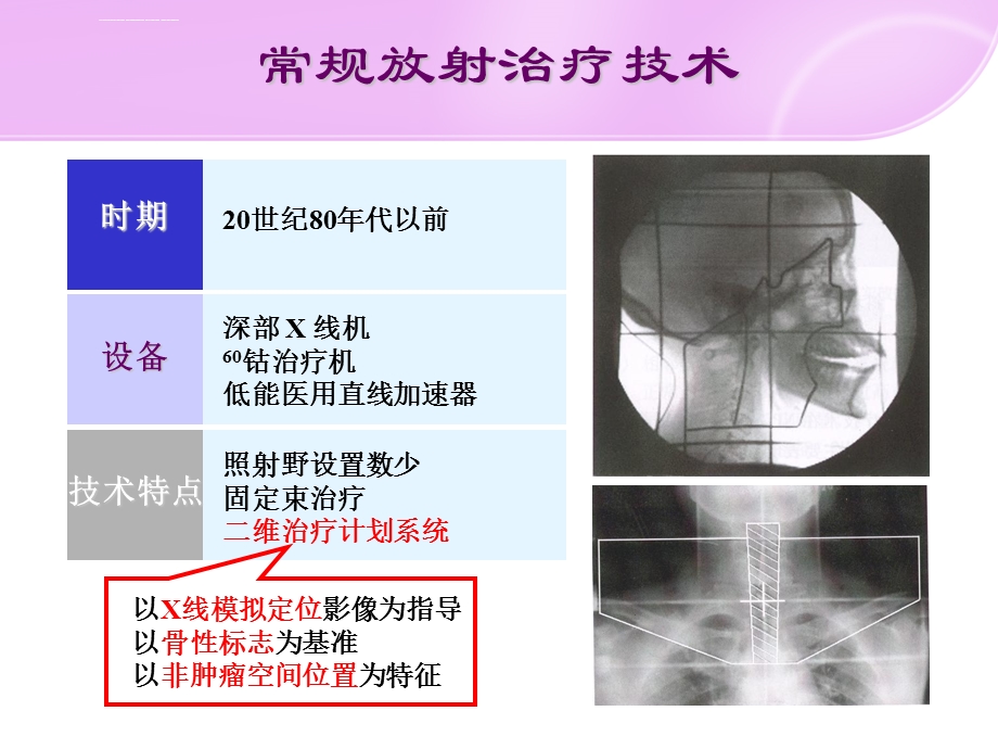 肿瘤放射治疗学调强放射治疗ppt课件.ppt_第3页