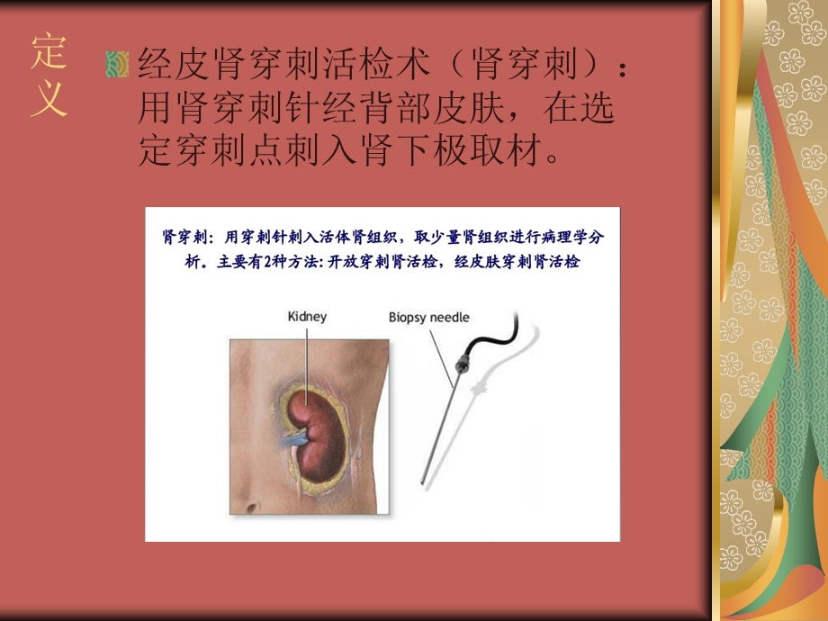 肾穿刺活检术ppt课件.ppt_第3页