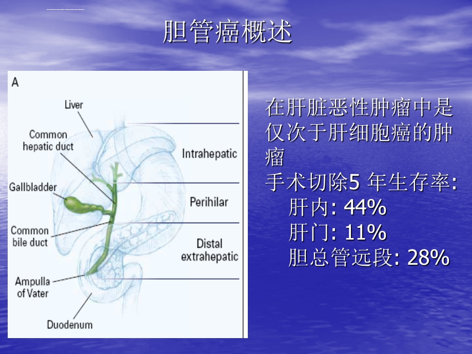 胆管癌的CT诊断ppt课件.ppt_第2页