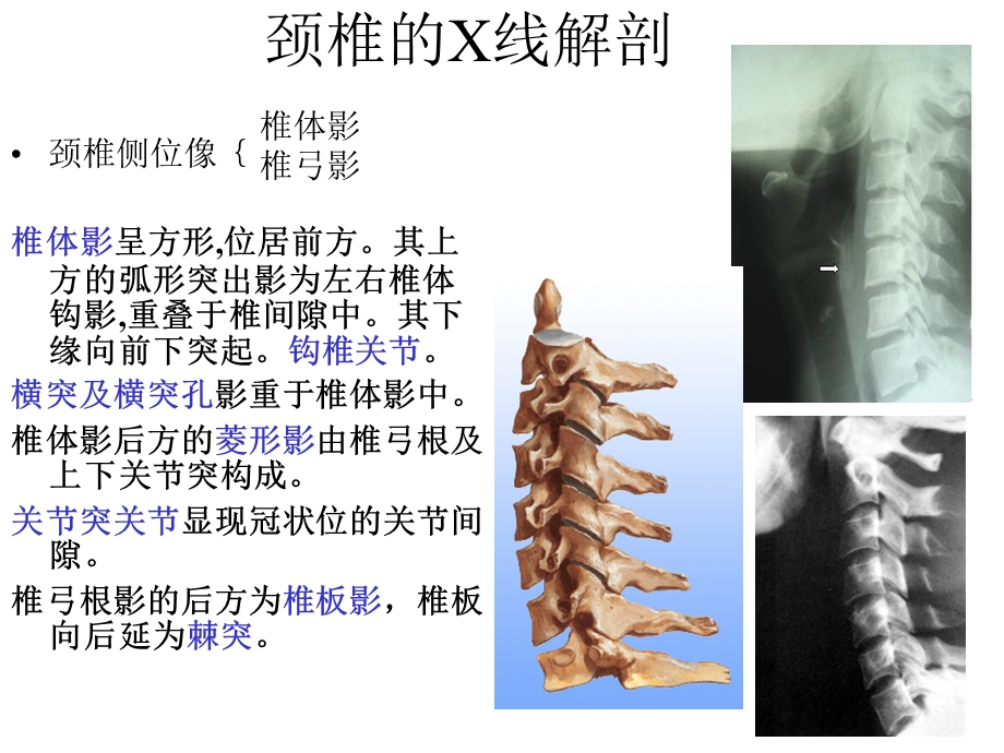 脊柱的X线解剖(精)ppt课件.pptx_第2页