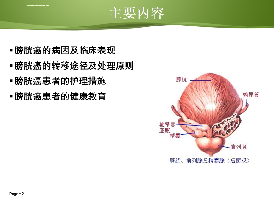 膀胱癌病人的护理及健康教育ppt课件.ppt_第2页