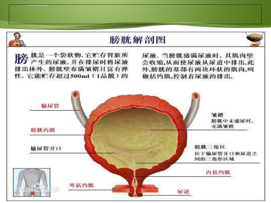 膀胱癌病人的护理及健康教育ppt课件.ppt_第3页