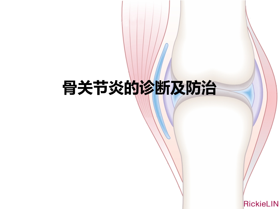 骨关节炎诊治患者教育ppt课件.pptx