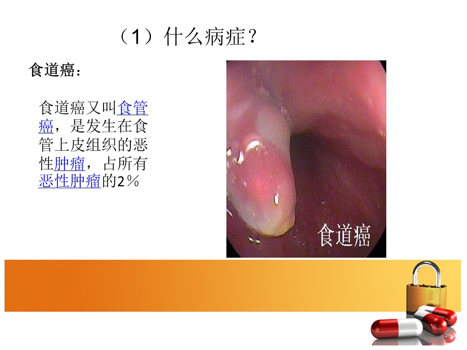 食道癌病例分析ppt课件.ppt_第3页